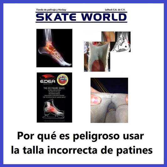 Riesgos de usar la talla equivocada de patines